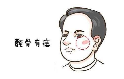 ,四大恶痣 ,四大恶痣
