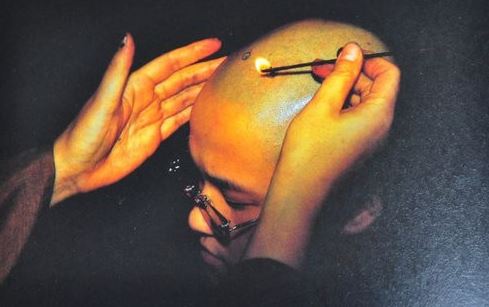 说烧戒疤起源于舍身供养的佛家思想,也被叫做断除我执 说烧戒疤起源于舍身供养的佛家思想,也被叫做断除我执
