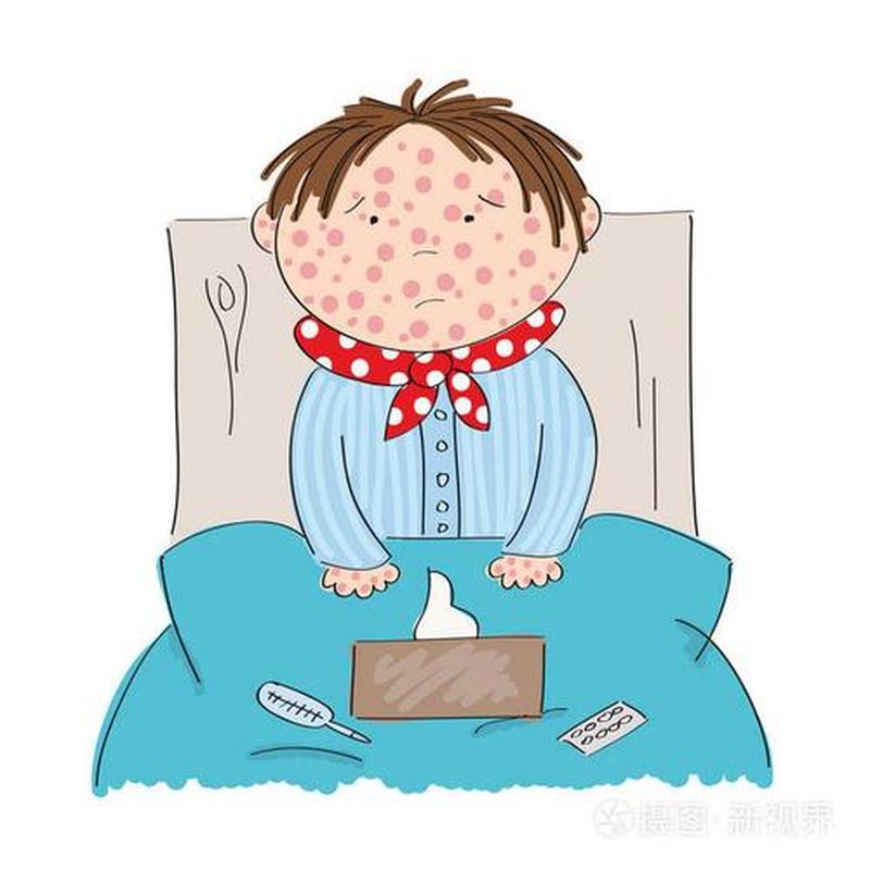 水痘 麻疹
